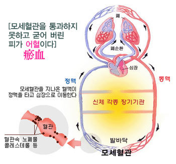 자연정혈요법 이미지
