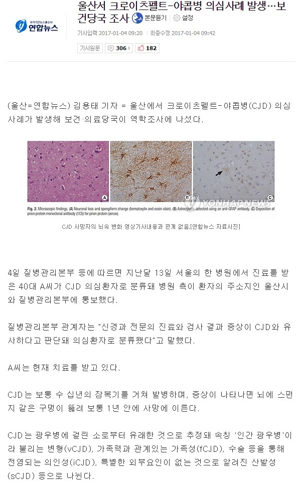 울산에서 광우병 의심사례 발생 | 인스티즈