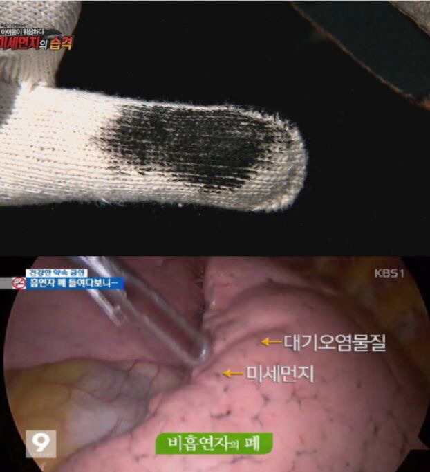 미세먼지의 위험성 | 인스티즈