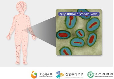 영국이 리얼 양애취 새끼인 이유.(배울게 없어서 그걸 배운 미국도) | 인스티즈