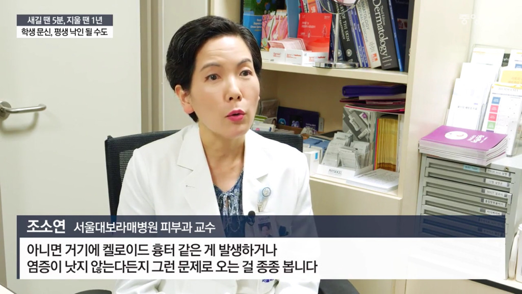 문신하고 후회하는 10대들 | 인스티즈