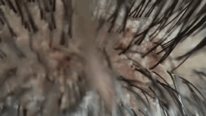 혐주의)비듬제거.GIF | 인스티즈